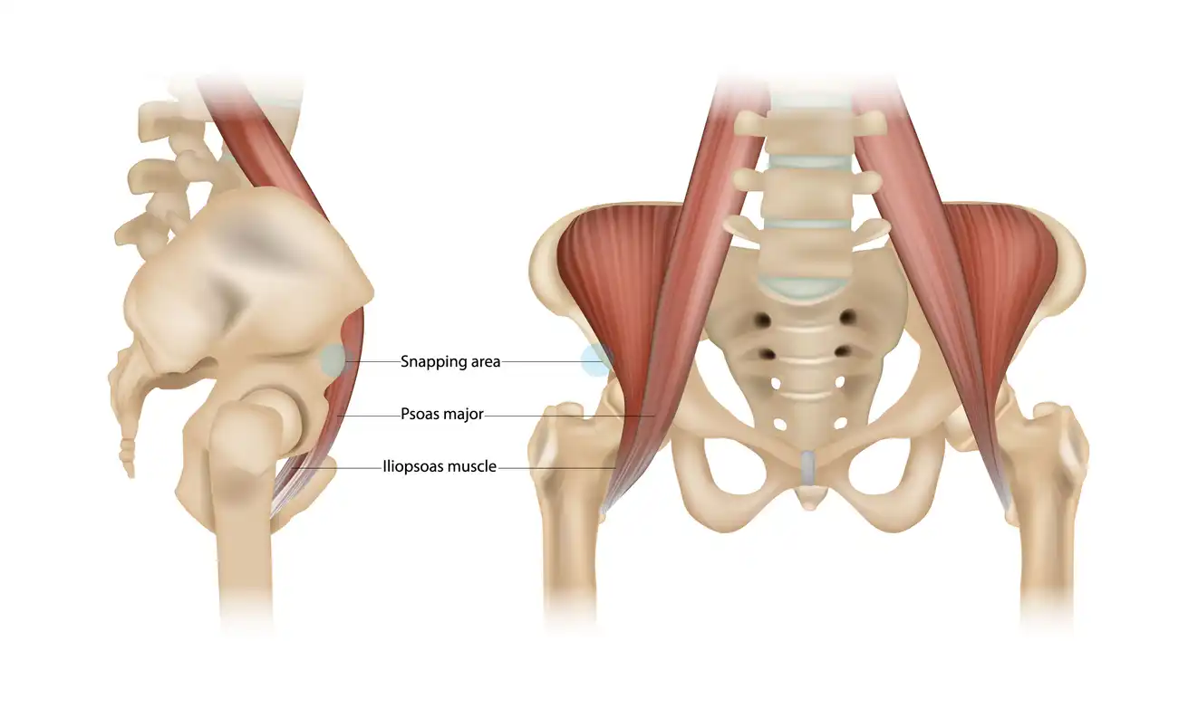 afbeelding van de psoas spier